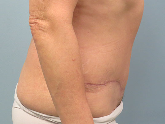 After Image