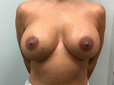 After Image