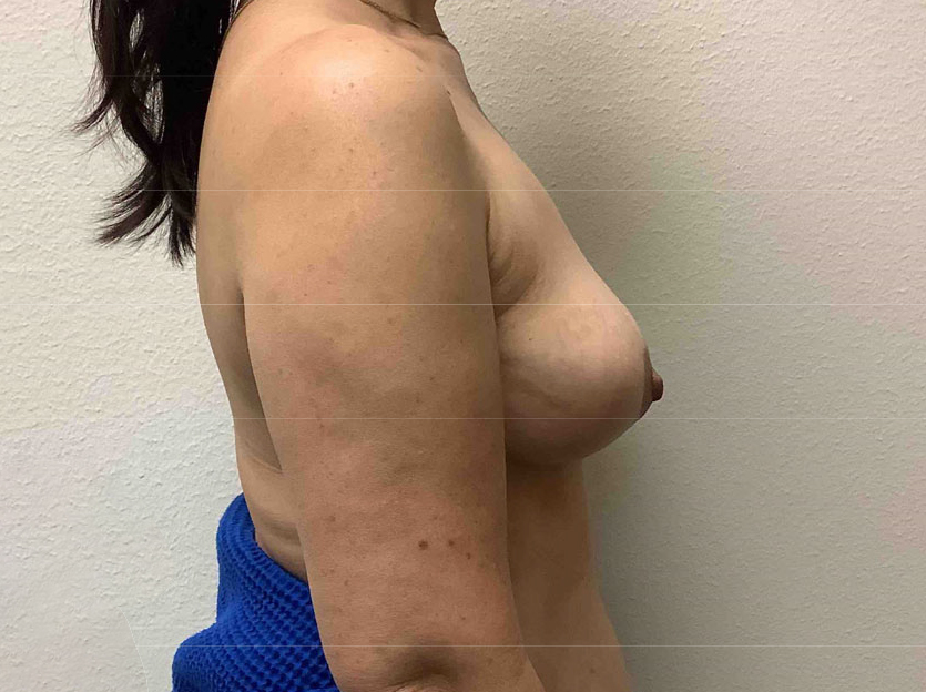 After Image