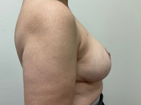 After Image