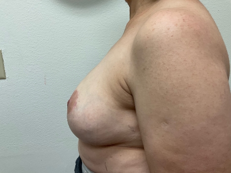 After Image